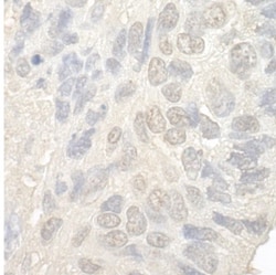 NOL12 Antibody, Novus Biologicals 0.1mg; Unlabeled:Antibodies, Polyclonal